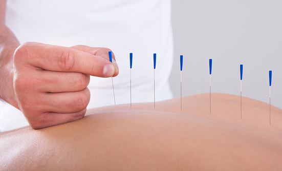 Acupuncture as Adjuvant Therapy for Cancer Pain