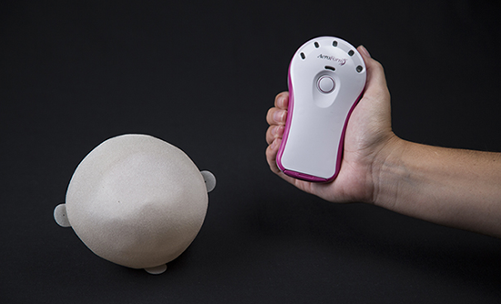 A Novel Tissue Expander System Offers New Options in Breast Reconstruction