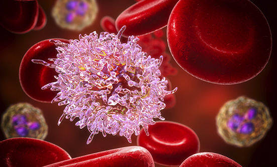 CAR T-Cell Therapy Emerging for Chronic Lymphocytic Leukemia