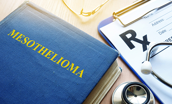 Mesothelioma: Asbestos Exposure Continues to Cause Cancer